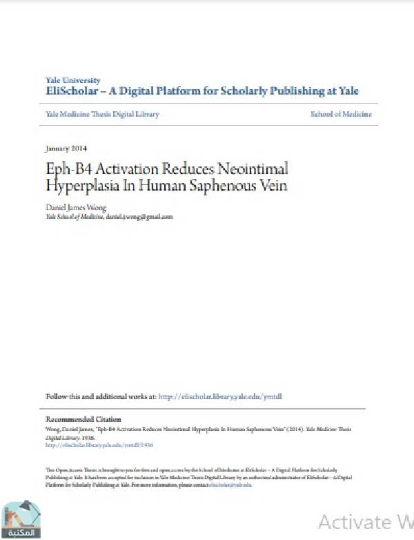 ❞ رسالة Eph-B4 Activation Reduces Neointimal Hyperplasia In Human Saphenous Vein ❝  ⏤ Daniel James Wong