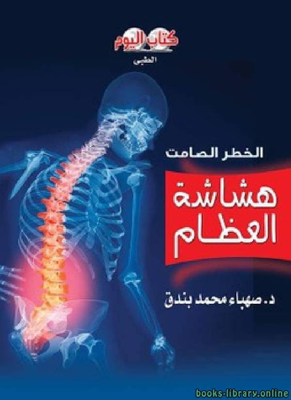 ❞ كتاب هشاشة العظام الخطر الصامت ❝  ⏤ صهباء محمد بندق