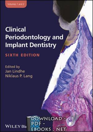 ❞ كتاب Clinical Periodontology and Implant Dentistry ❝  ⏤ ثوركيلد  كرينج