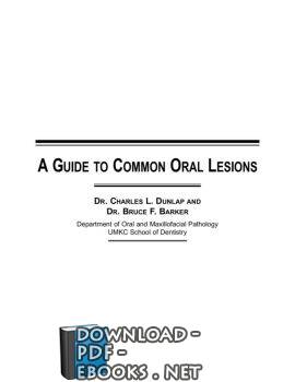 قراءة و تحميل كتاب A GUIDE TO COMMON ORAL LESIONS PDF