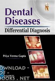 قراءة و تحميل كتابكتاب Differential Diagnosis of Dental Diseases PDF