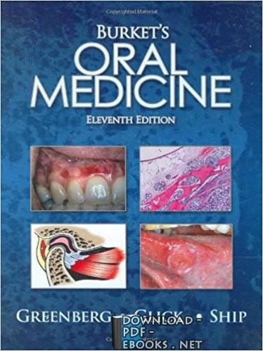 قراءة و تحميل كتاب ORAL MEDICINE Eleventh Edition PDF