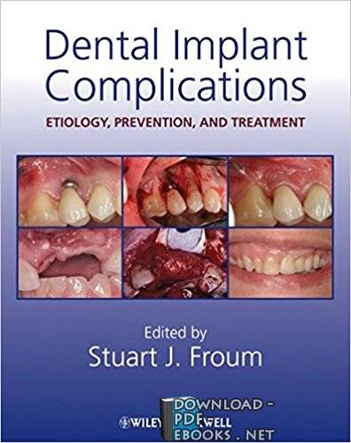 قراءة و تحميل كتابكتاب Dental Implant Complications PDF