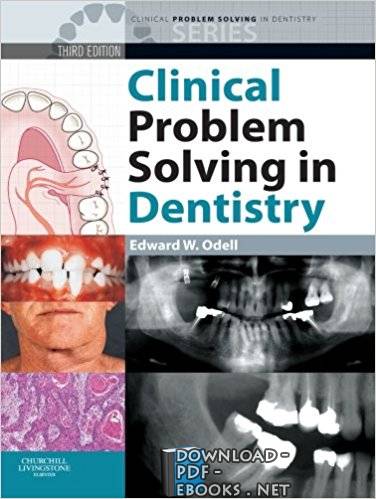 قراءة و تحميل كتابكتاب Clinical Problem Solving in Dentistry PDF