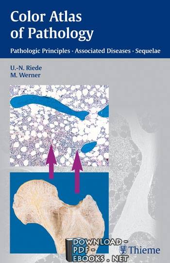قراءة و تحميل كتابكتاب color atlas of pathology PDF